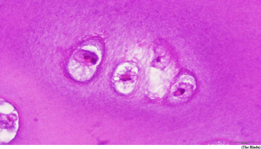Haemoglobin isn&rsquo;t used only in blood, scientists discover (GS Paper 2, Health)