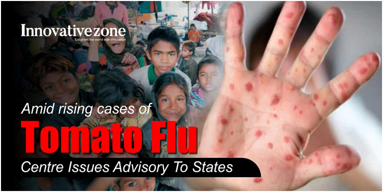 Centre issued an advisory for &lsquo;Tomato flu&rsquo; (GS Paper 3, Science and Tech)