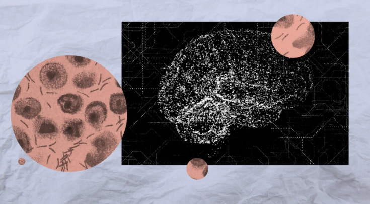 Early Detection of Parkinson&rsquo;s Disease Using AI (GS Paper 3, Science & Technology)
