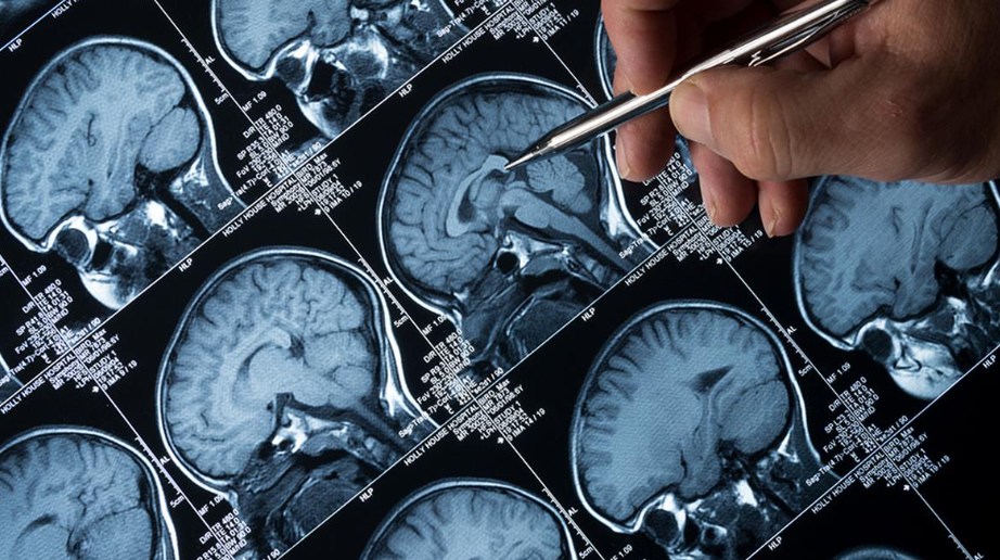 Low-Cost MRI Machine Enhances Access to Diagnostics in India (GS Paper 3, Technology)
